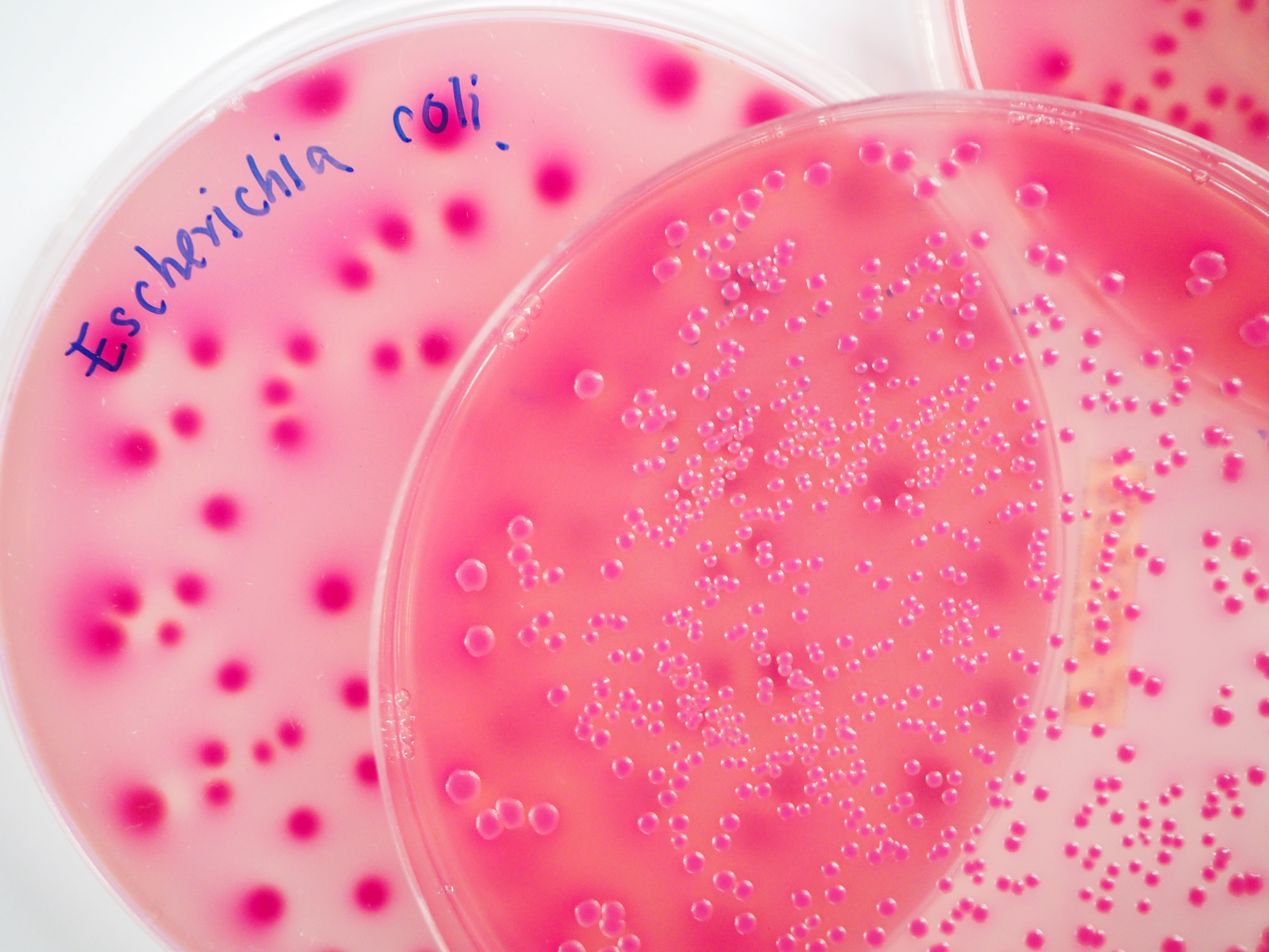 Escherichia coli (E. Coli)  growth